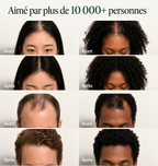 Barre Coréenne Revitalisante pour le Cuir Chevelu